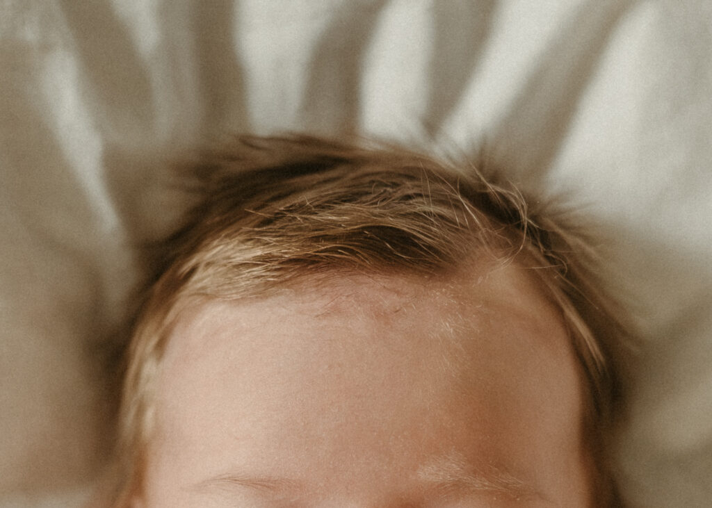 close up of newborn hairline and forehead